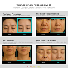 Load image into Gallery viewer, [K-Beauty] VIVIDESTEL Edelweiss Collagen 3GF+ Nutrition Cream 80ml
